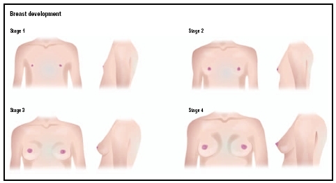 Stages of breast and pubic hair development. Stage 1 is