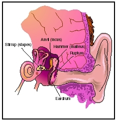 eardrum hole